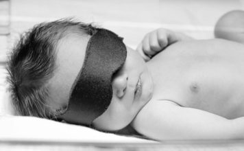Prolonged Jaundice in Newborns - Causes, Symptoms, Investigation, And Treatment