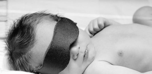 Prolonged Jaundice in Newborns - Causes, Symptoms, Investigation, And Treatment