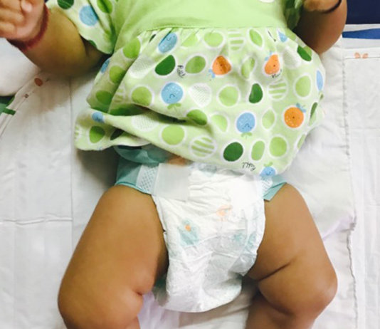 Review | Why I Opted For Pampers Baby Dry Diapers For My Newborn