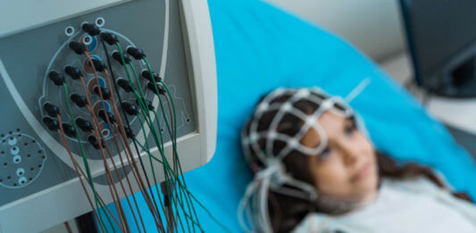 Epilepsy in Babies -Treatments of Epilepsy in Babies Epilepsy in Babies -Treatments of Epilepsy in Babies