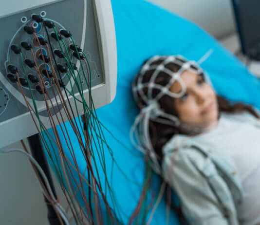 Epilepsy in Babies -Treatments of Epilepsy in Babies