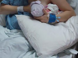 Breastfeeding after cesarean section