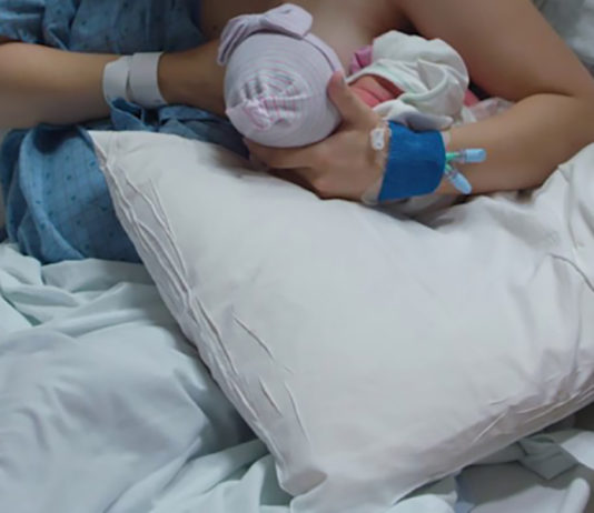 Breastfeeding after cesarean section